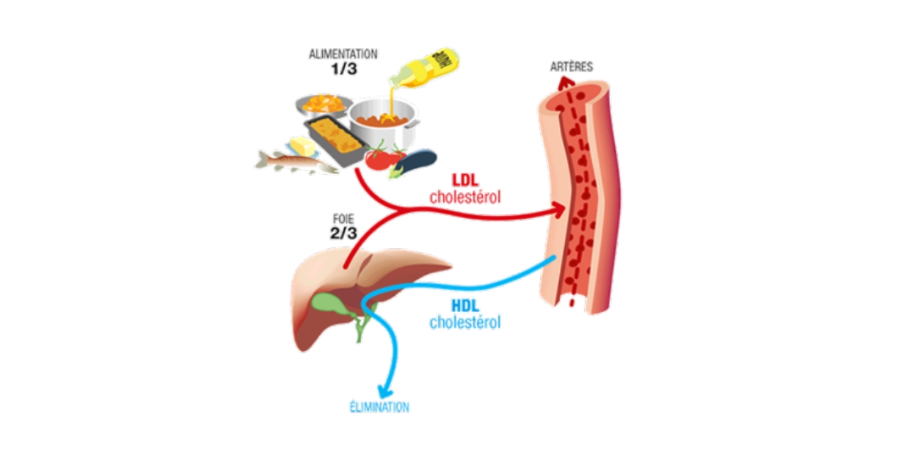 Le schéma illustre l'impact de l'alimentation sur le cholestérol.